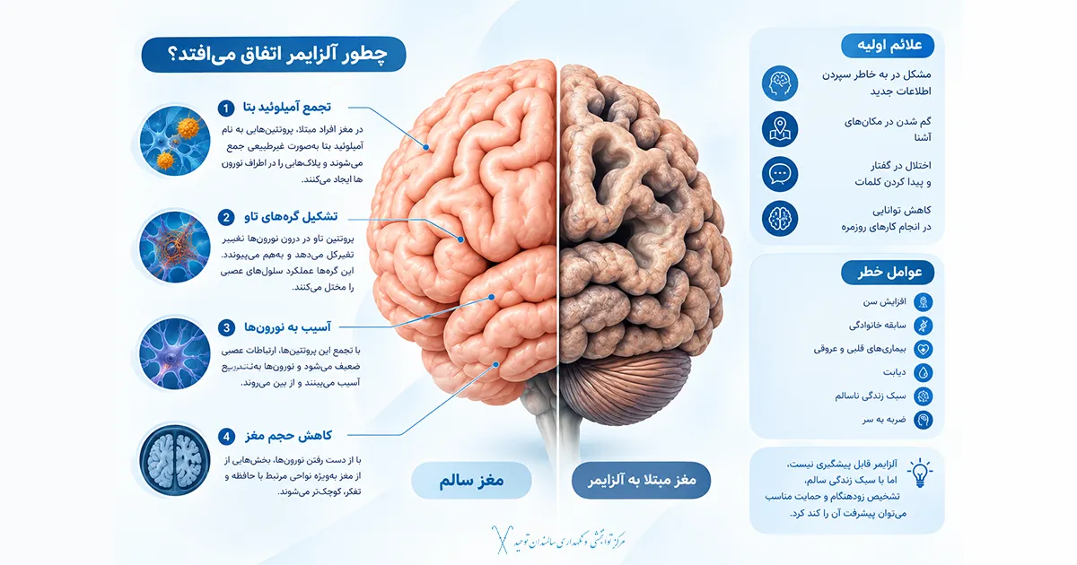 آلزایمر چیست و چگونه اتفاق میوفتد؟